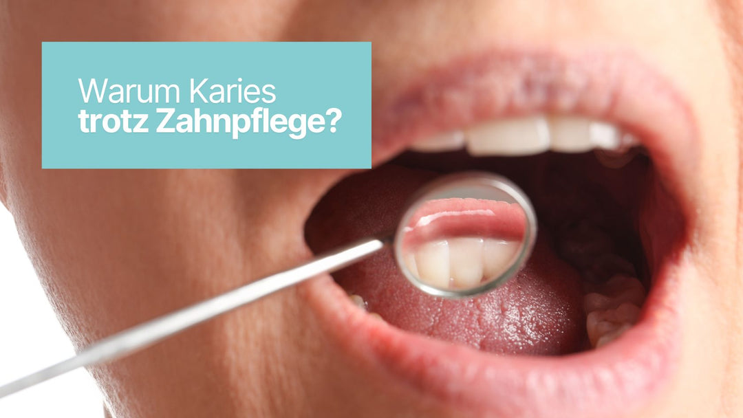 Warum Karies trotz Zahnpflege? Die Faktoren, die zu Karies führen können